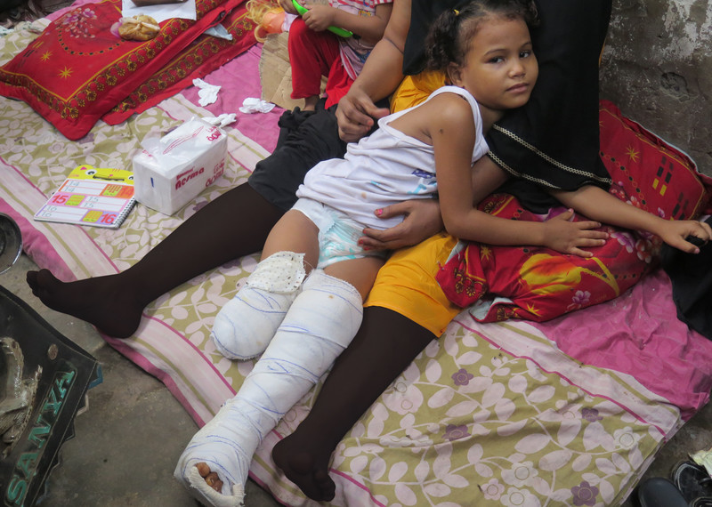 7-year-old Samia who was badly injured by shrapnel when a rocket smashed through the roof of her home in Aden on 1 July 2015. The rockets, which were fired from between two anti-Huthi Popular Resistance Committee checkpoints into heavily populated neighborhoods, killed 13 people, most of them civilians, and injured 56 others. © Amnesty International