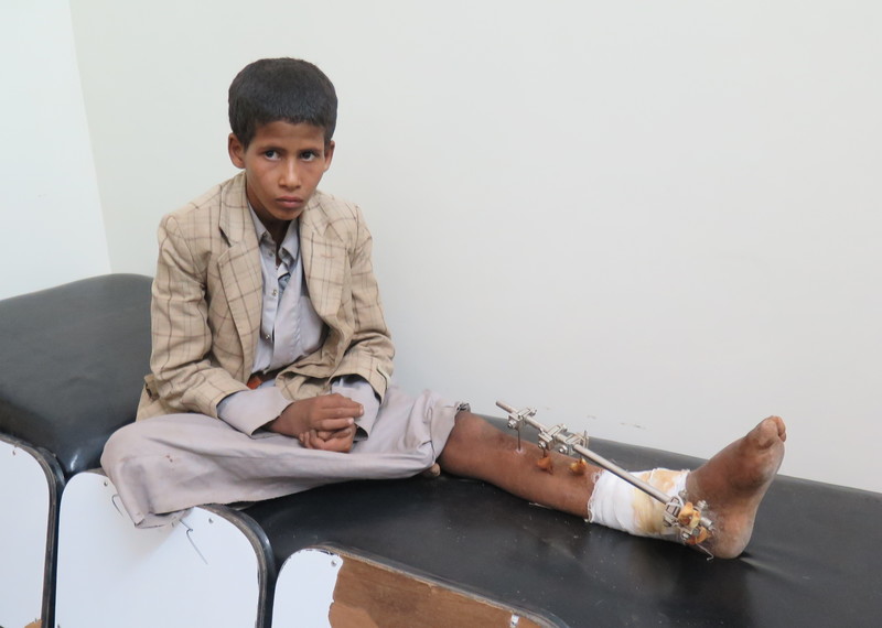 Mohammed Hamood al-Wabash, who was injured by a cluster bomb, Sa'da