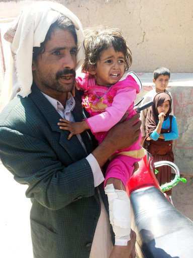 Four year old Hasna Mohamed Hussein Jumaan's left leg was injured a couple of day after the attack when she came into contact with an unexploded submunition. Pictured with her her father, Mohamed Hussein Jumaan.