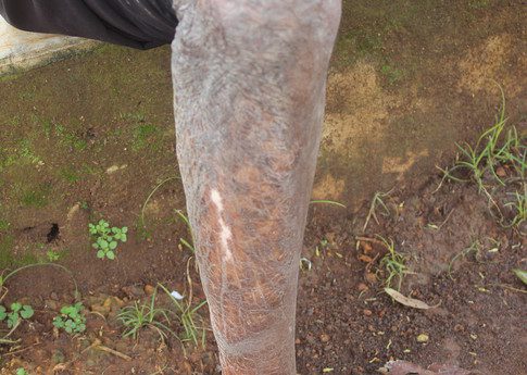 The burnt leg of Philip Kimunya who was 15 years old in 2007 when the violence broke out, he escaped from the burning Kiambaa Church in Eldoret. ©Amnesty International