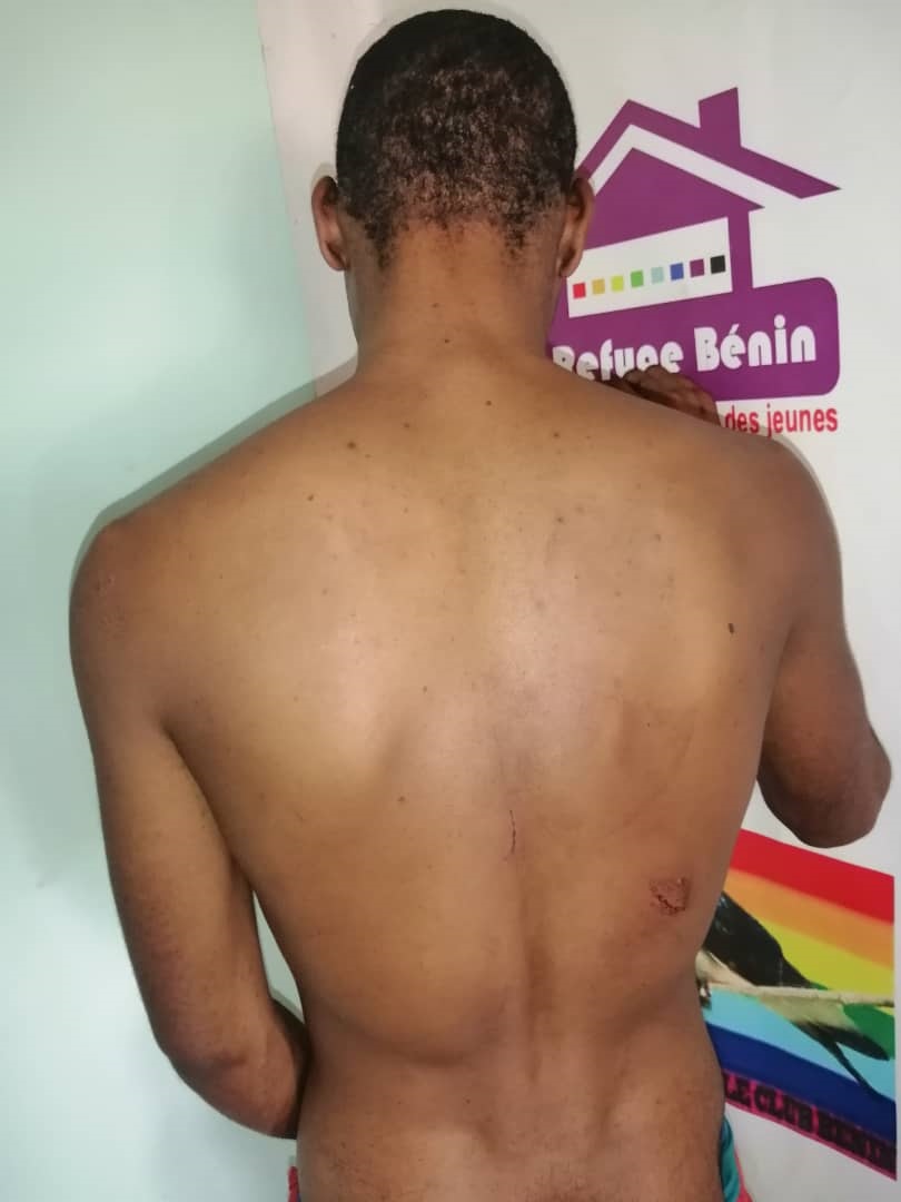 Benin Police accused of violently attacking transgender woman photo
