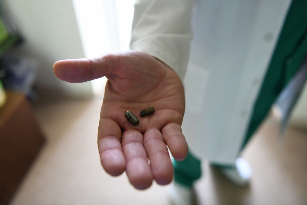 A doctor shows cluster munitions fragments which were removed from the body of one of the people injured in the cluster bomb attack on Myru Street on 15 April.