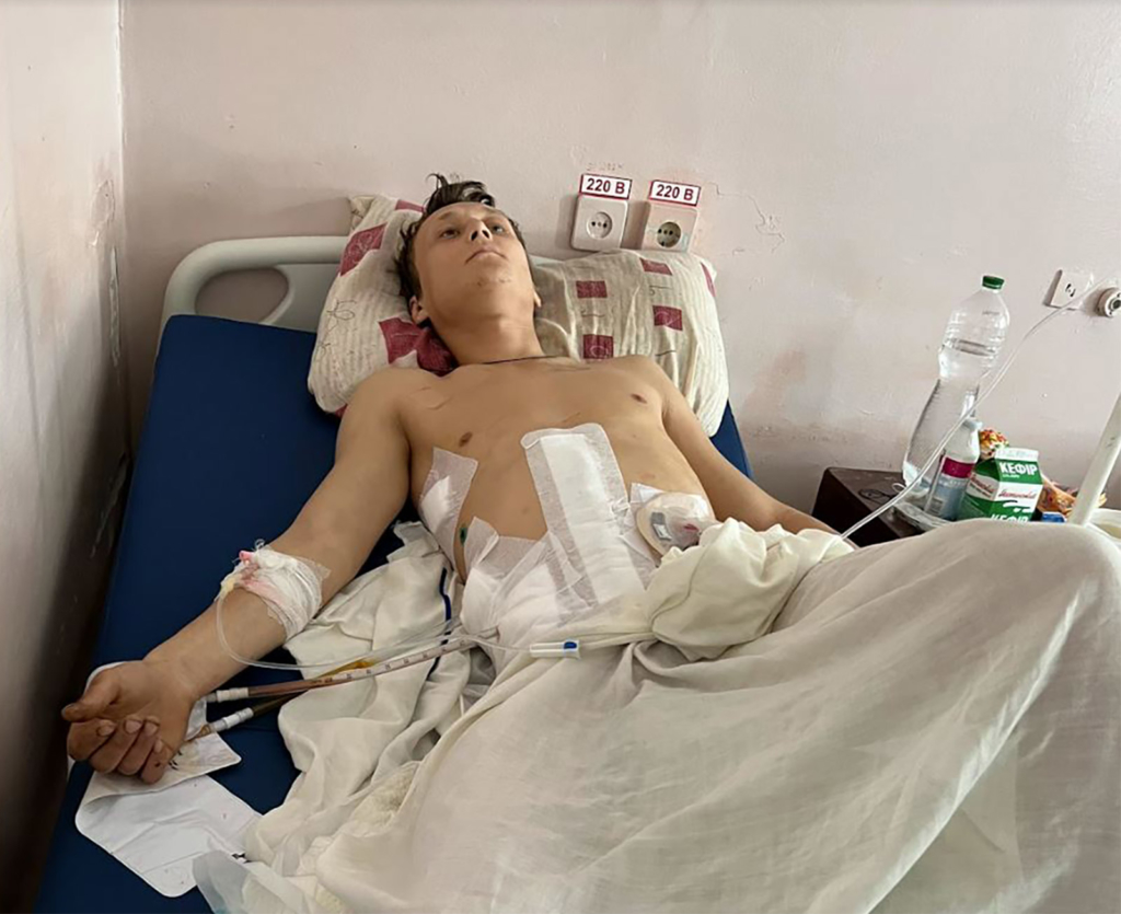 Oleksandr Marchenko was injured while walking near his home by shrapnel from a volley of Grad rockets which struck a housing complex off Heroiv Pratsi Street on 23 April.