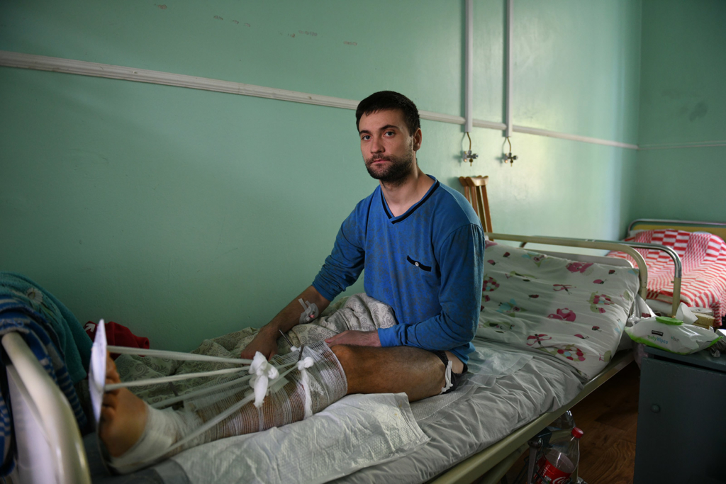 Bohdan Burlutskyi , injured in the cluster bomb strike on Myru St