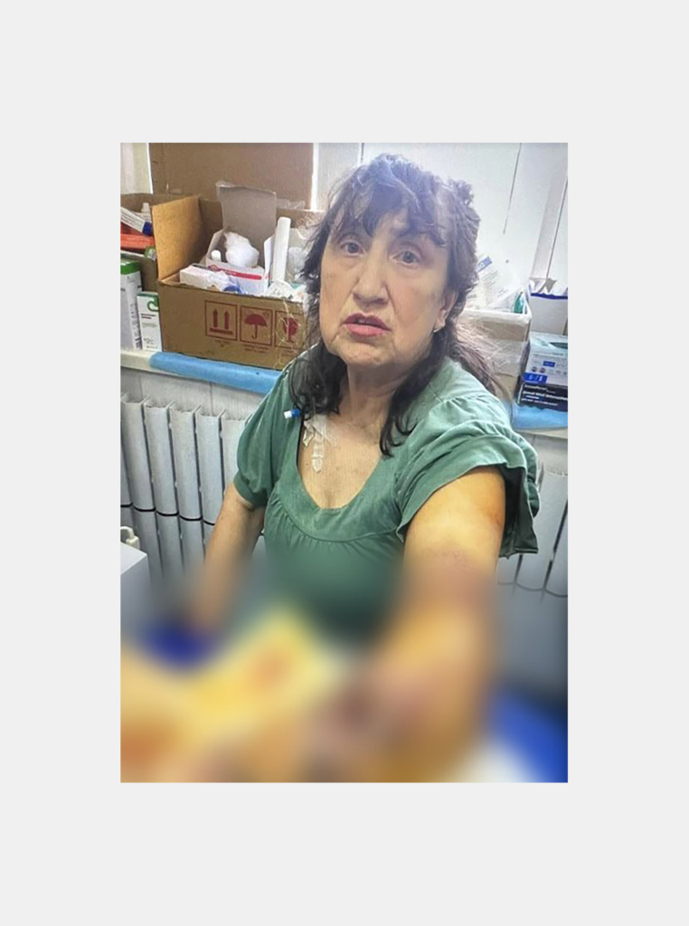 Liubov Aleksandrova was in her garden in the Kharkiv suburb of Kotliary on 21 April when she was injured in a rocket srike, suffering multiple fractures and lacerations to her