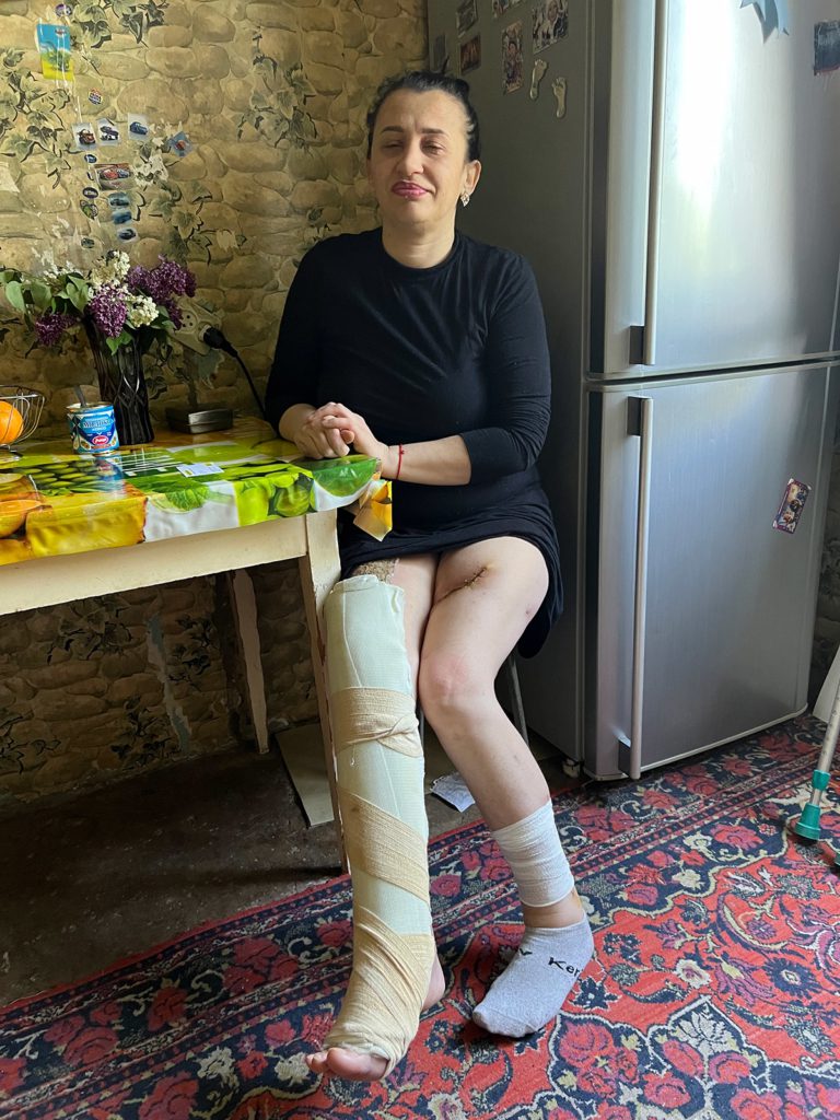 Olena was among several people injured when shrapnel from scatterable mines exploded in the playground in front of her building in the Saltivka neighbourhood on 11 April.