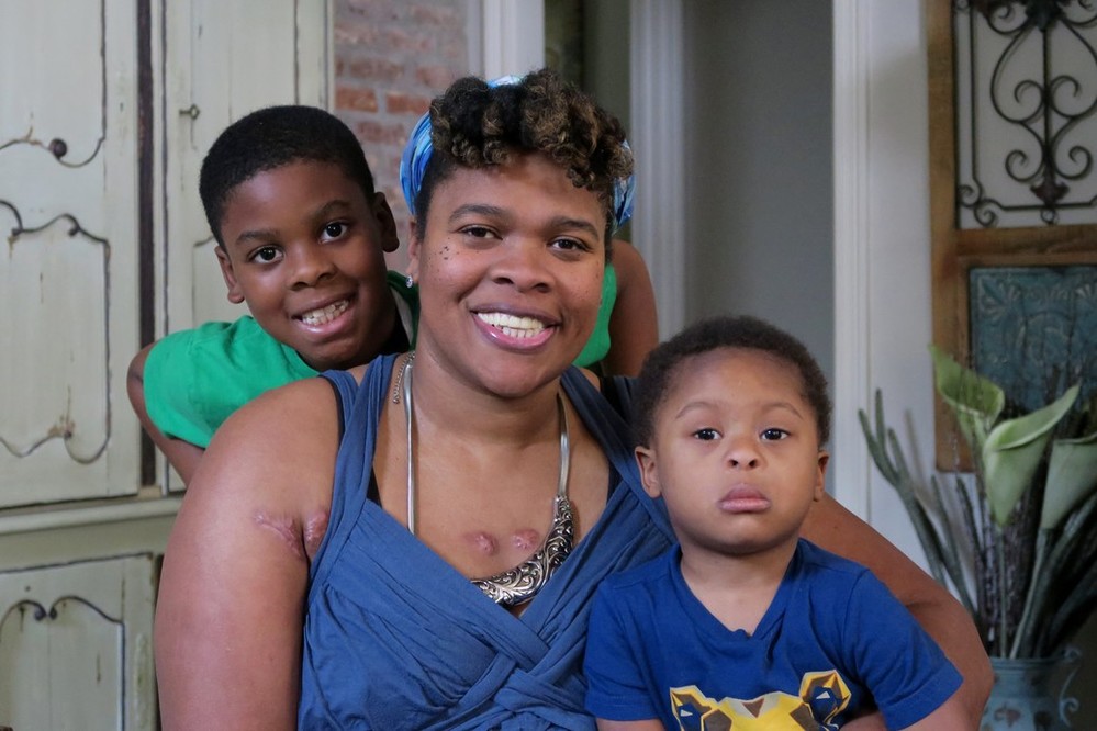 Angela, a survivor of gun and domestic violence sits with her two young sons. The trio are smiling, but you can see visible scars on Angela’s chest that were the result of domestic violence. 