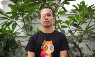 Payu: “A rubber bullet cost me an eye at a protest, but I am still protesting”