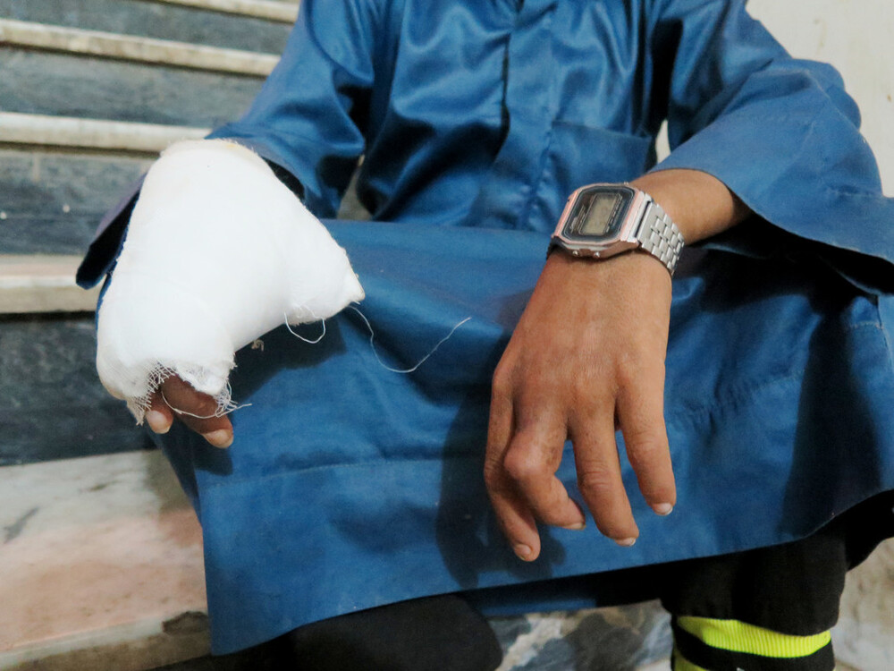 a photo of a boy, with his face out of frame. one of his hands is heavily wrapped in gauze. on his other hand, a you can see that one of his fingers is severely damaged. He is wearing a grey digital watch. 