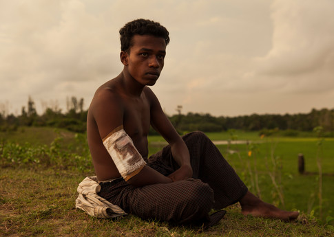 Mohammed essayait de fuir quand on lui a tiré dans la jambe © Amnesty International