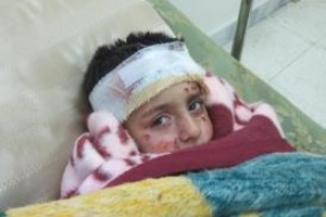 Un des nombreux enfants admis dans un hôpital de campagne à Alep après avoir été blessé par des bombes à sous-munition utilisées par l’armée de l’air syrienne. © Amnesty International