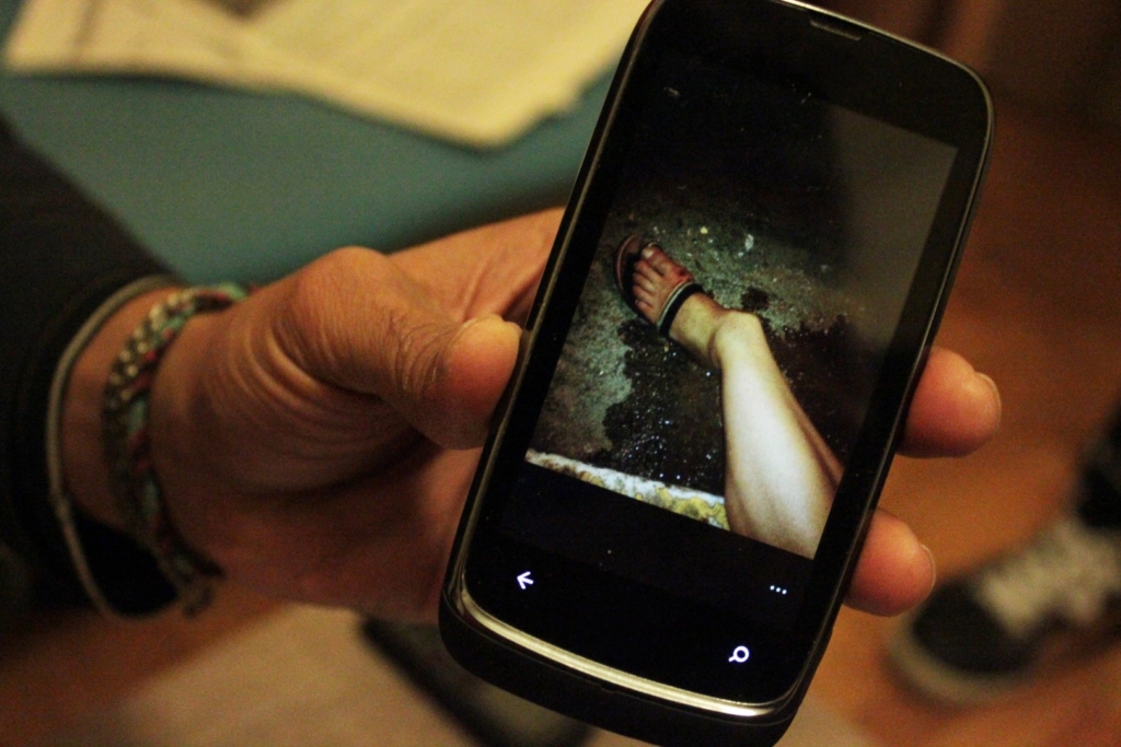 Photo sur un téléphone portable montrant la jambe cassée de Costas après l'agression. © DR