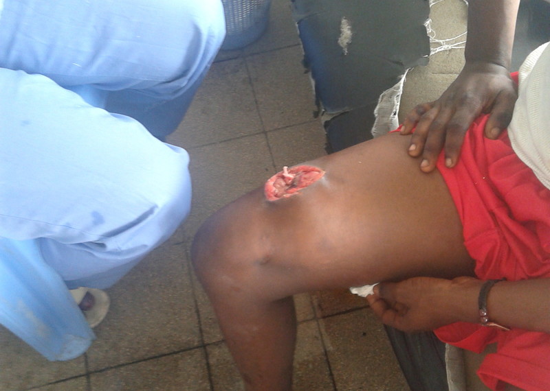 Un jeune homme recevant des premiers soins dans un centre médical à Kinshasa. Il a été blessé par une balle de la police lors de la manifestation du 21 janvier 2018. Il a raconté à Amnesty International que la police l’avait conduit au centre médical après avoir confisqué son argent et ses téléphones portables.
