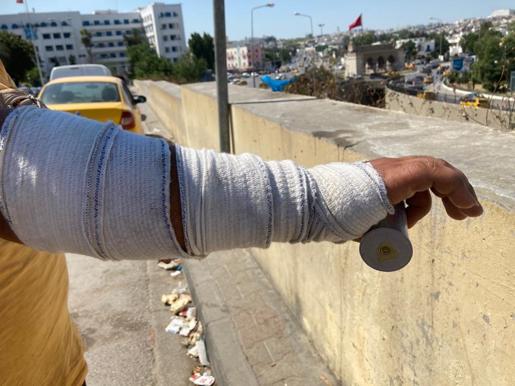 Alaa Hosni a été blessé quand les forces de sécurité ont surgi à son domicile, l'ont roué de coups et ont procédé à des tirs de gaz lacrymogène qui ont presque asphyxié son bébé ©Amnesty International